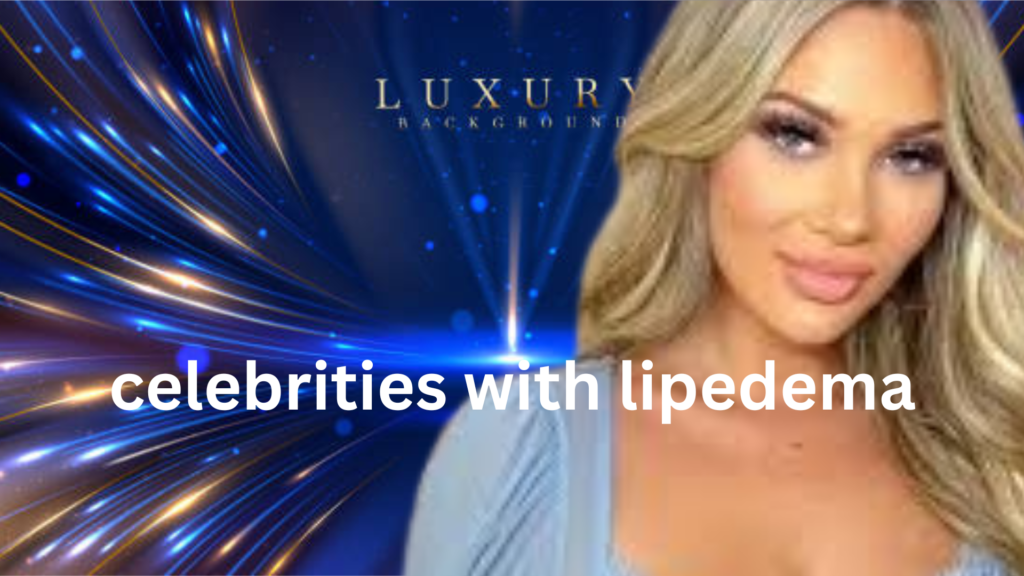 celebrities with lipedema